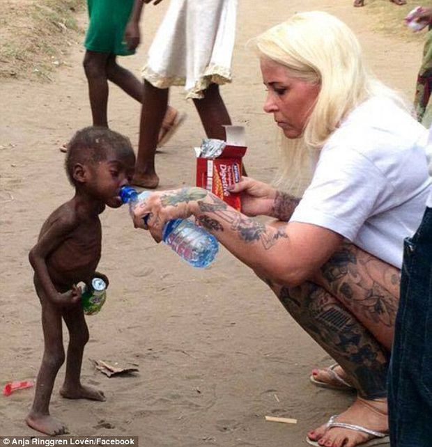 32B67C3A00000578-3517808-Heartbreaking_Nigerian_boy_now_named_Hope_pictured_was_emaciated-a-3_1459448367521